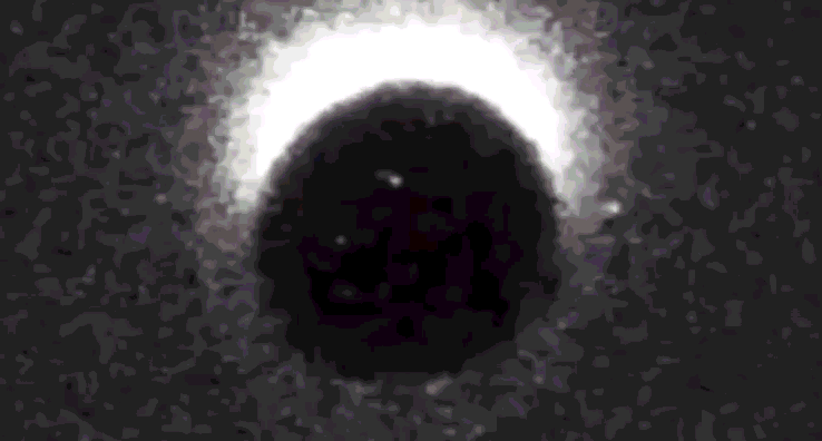 L'« étincelle de zinc » : la libération de zinc rendue visible par une sonde fluorescente lors de l'activation d'un ovocyte (images de laboratoire)
